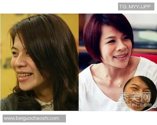 戴过牙套的足球明星们如何在赛场上展现自信与魅力